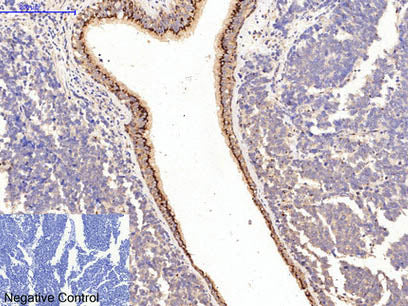 COL1A1 Monoclonal Antibody