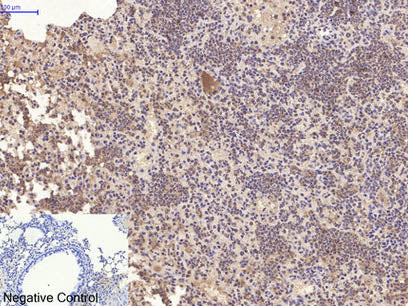 CD10 Monoclonal Antibody