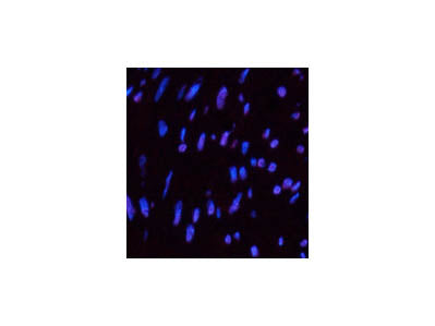 CD10 Monoclonal Antibody