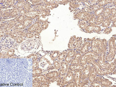 CD10 Monoclonal Antibody