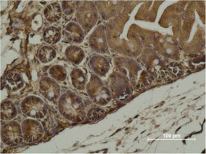 ACTA2 Monoclonal Antibody