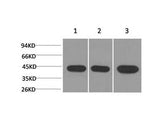 ACTA2 Monoclonal Antibody