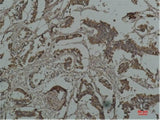 HSP27 Monoclonal Antibody