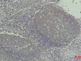 TNF Alpha Monoclonal Antibody
