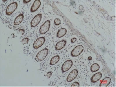 HSP90 Alpha Monoclonal Antibody