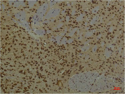 PI 3 Kinase p85 Alpha Monoclonal Antibody