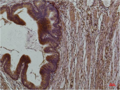 STAT3 Monoclonal Antibody Store at -20°C