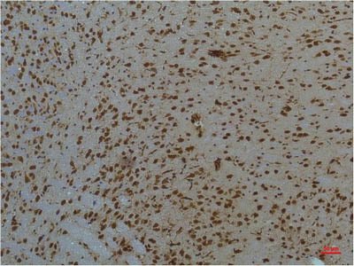 STAT3 Monoclonal Antibody Store at -20°C