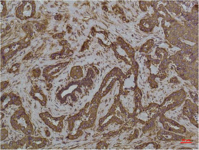 HSPA5 Monoclonal Antibody Store at -20°C