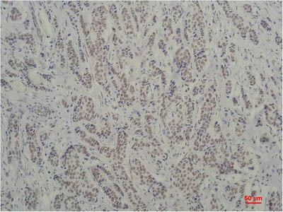 TBP Monoclonal Antibody Store at -20°C