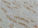 NFKBIB Monoclonal Antibody