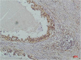 NFKBIB Monoclonal Antibody