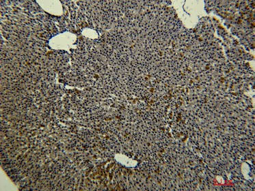 Transferrin Monoclonal Antibody Store at -20°C Immunogen Protein