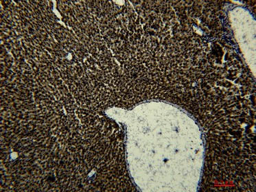 Transferrin Monoclonal Antibody Storage Store at -20°C Reactivity Human