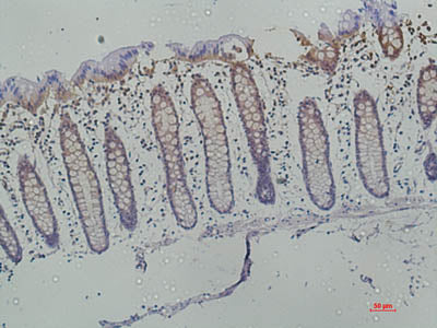 Galectin 3 Monoclonal Antibody Storage Store at -20°C Reactivity Human