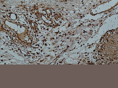 Galectin 3 Monoclonal Antibody Storage Store at -20°C Host Mouse