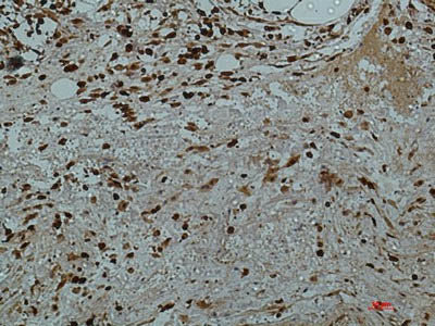 Galectin 3 Monoclonal Antibody Storage Store at -20°C Host Mouse