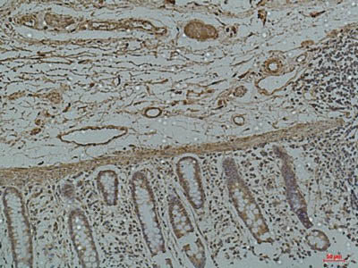 Galectin 3 Monoclonal Antibody Storage Store at -20°C