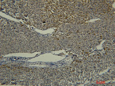 Transferrin Monoclonal Antibody Storage Store at -20°C