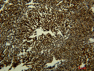 Transferrin Monoclonal Antibody Storage Store at -20°C Host Mouse