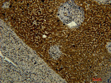 Transferrin Monoclonal Antibody Storage Store at -20°C Host Mouse