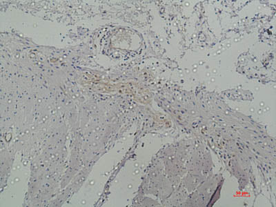 Galectin 3 Monoclonal Antibody Store at -20°C Host Mouse