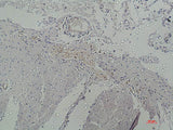 Galectin 3 Monoclonal Antibody Store at -20°C Host Mouse