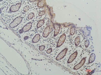Galectin 3 Monoclonal Antibody
