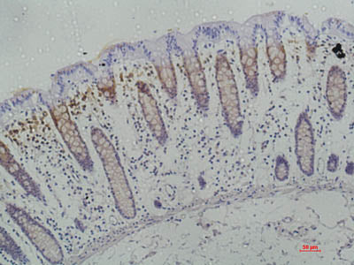 Galectin 3 Monoclonal Antibody Store at -20°C