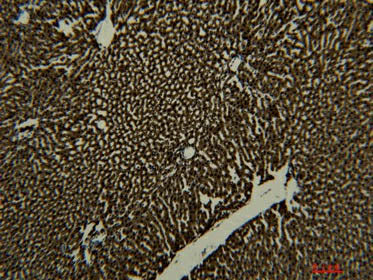Transferrin Monoclonal Antibody Store at -20°C Reactivity Human