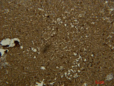 Transferrin Monoclonal Antibody Store at -20°C Reactivity Human