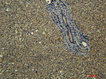 Transferrin Monoclonal Antibody Store at -20°C Host Mouse