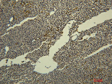 Transferrin Monoclonal Antibody Store at -20°C