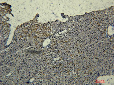 Transferrin Monoclonal Antibody
