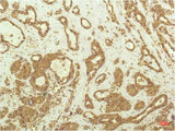 p70 S6 Kinase Alpha Monoclonal Antibody