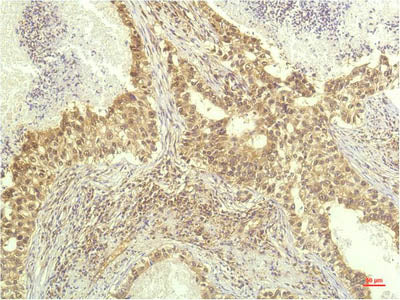p70 S6 Kinase Alpha Monoclonal Antibody