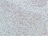 PPARD Monoclonal Antibody