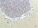PPARD Monoclonal Antibody