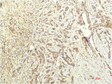 STAT1 Monoclonal Antibody