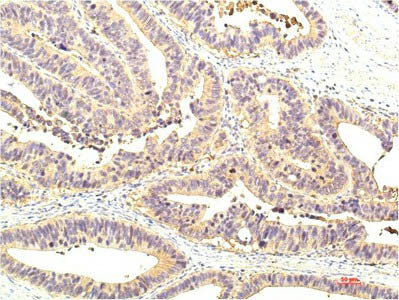 STAT1 Monoclonal Antibody