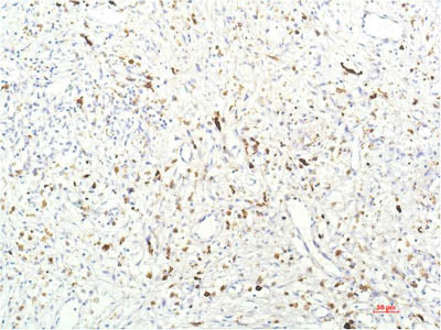 JAK1 Monoclonal Antibody
