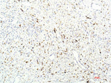 JAK1 Monoclonal Antibody