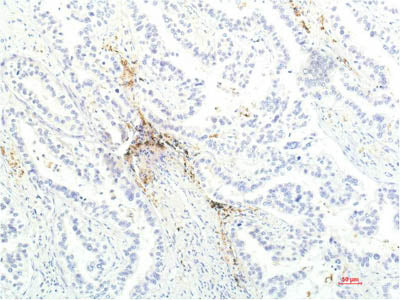 JAK1 Monoclonal Antibody
