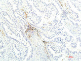 JAK1 Monoclonal Antibody