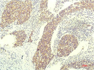 STAT1 Monoclonal Antibody Store at -20°C