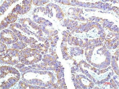 STAT1 Monoclonal Antibody Store at -20°C