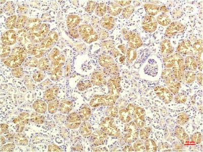 IL8 Monoclonal Antibody