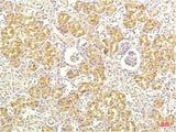 IL8 Monoclonal Antibody