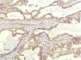IL8 Monoclonal Antibody