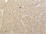 SGK1 Monoclonal Antibody
